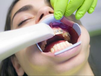 Wisdom Teeth Removal Procedure